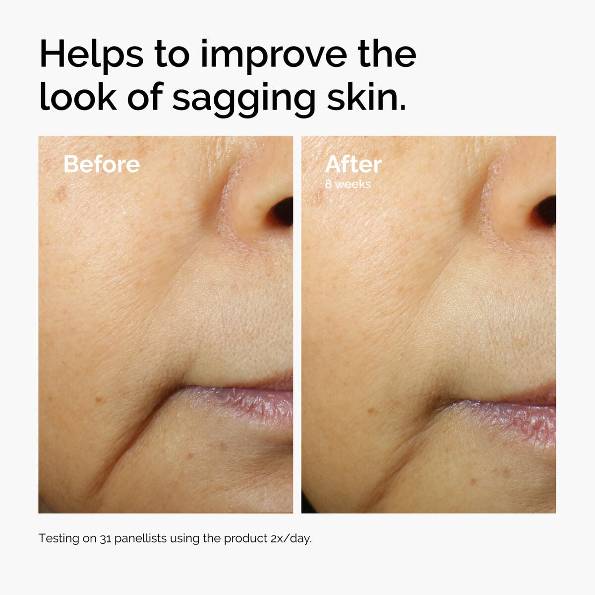 caffeine-3-escin-1-face-serum-g7 ord-caffeine-3pct-escin-1pct-face-serum-before-after-sagging.jpg