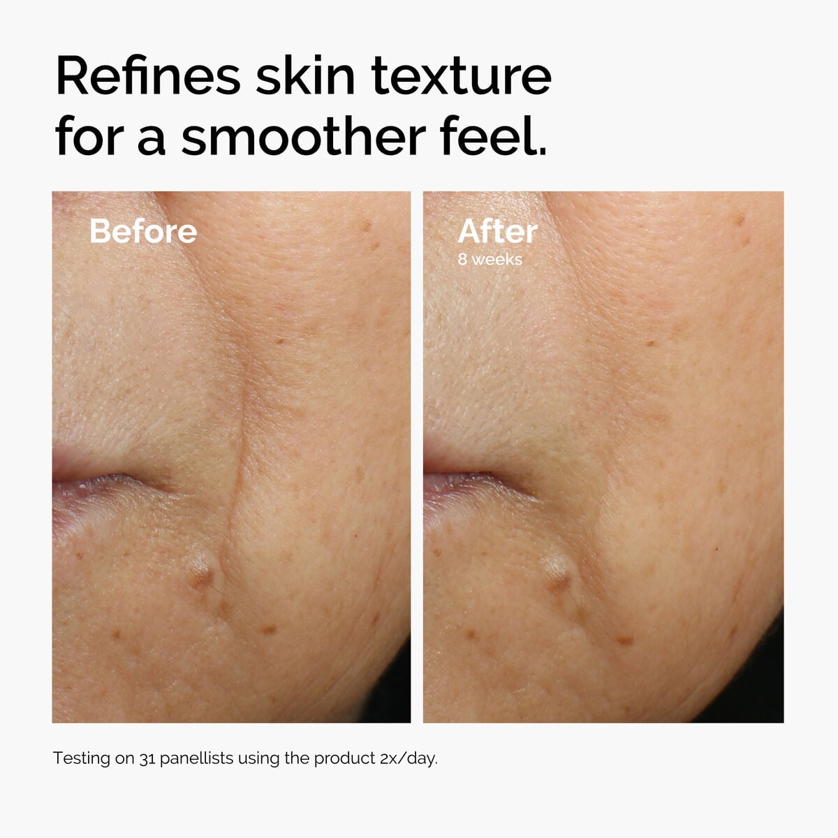 caffeine-3-escin-1-face-serum-g7 ord-caffeine-3pct-escin-1pct-face-serum-before-after-texture.jpg