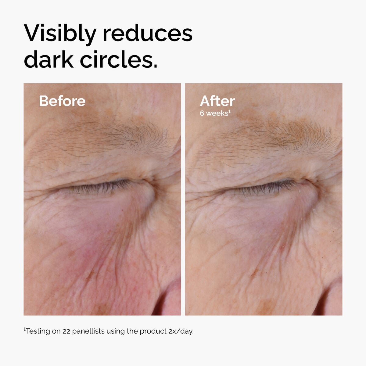 caffeine-solution-5-egcg-eye-serum-f4 ord-caffeine-solution-egcg-dark-circles-before-after.jpg
