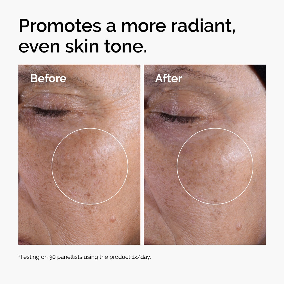 glycolic-acid-7-exfoliating-toner-r7 ord-glycolic-before-after-radiance.jpg