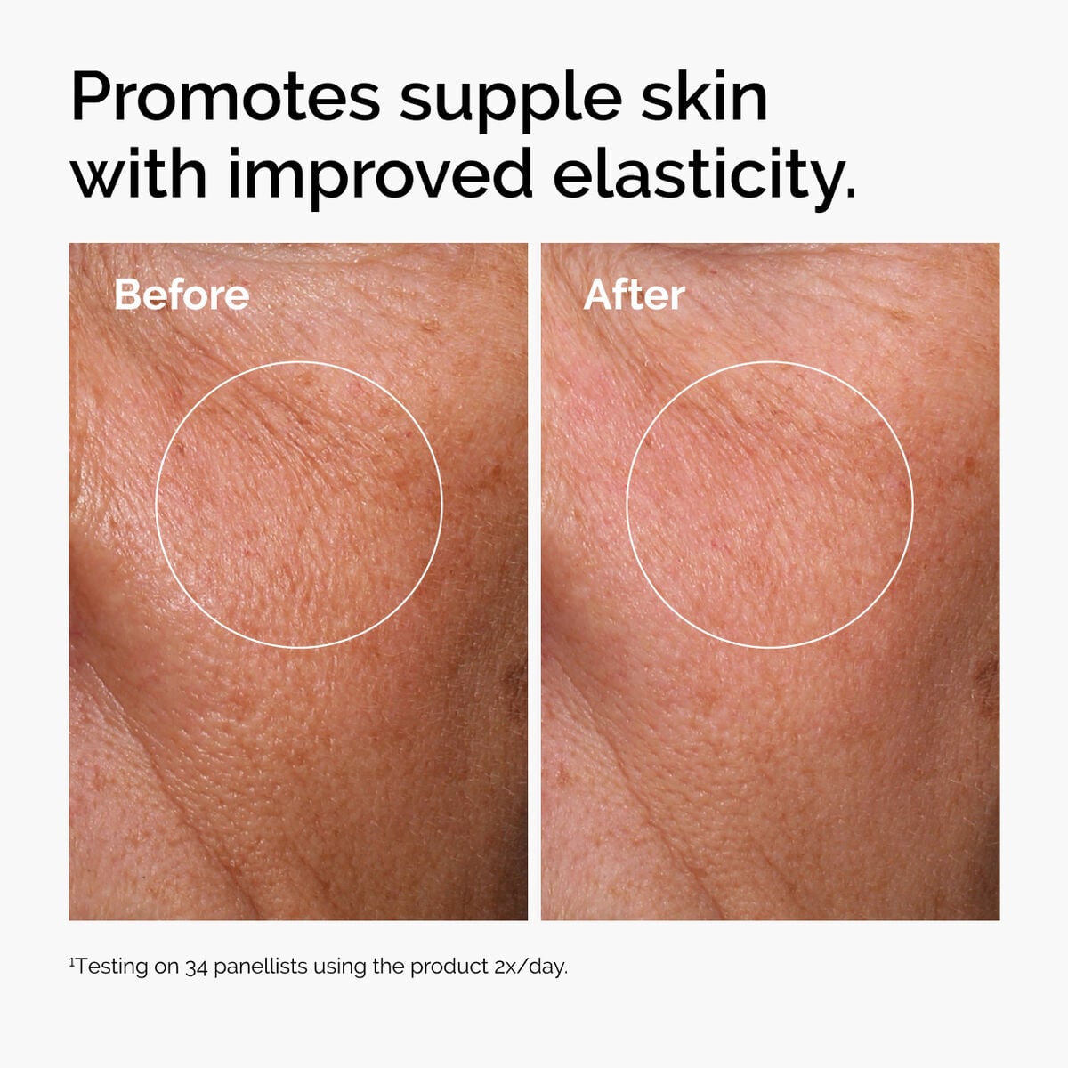 hyaluronic-acid-2-b5-with-ceramides-k2 ord-hyaluronic-acid-2pct-b5-hydrating-serum-before-after-elasticity.jpg