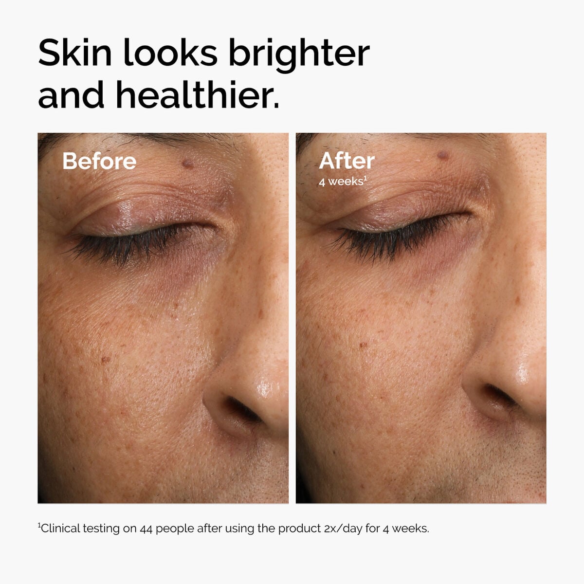 multi-antioxidant-radiance-serum-x0 ord-mars-before-after-healthy.jpg