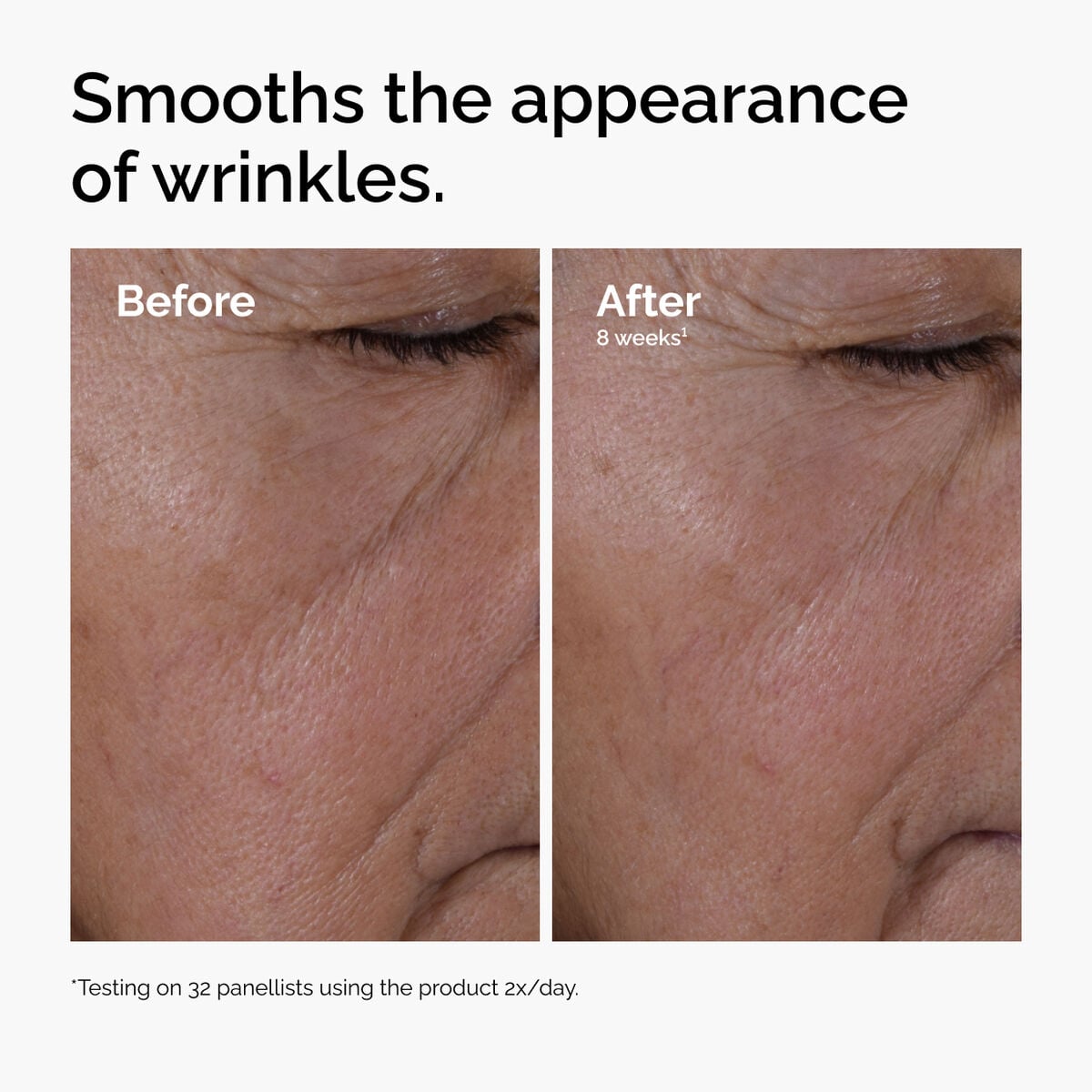 multi-peptide-ha-serum-c9 ord-multi-peptide-ha-serum-wrinkles-before-after.jpg